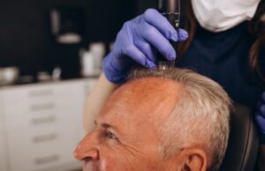 Hair Transplant in USA